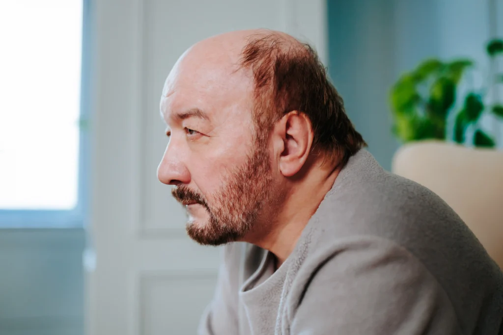 Epilepsia aposenta? Quais os requisitos, como funciona e como solicitar
